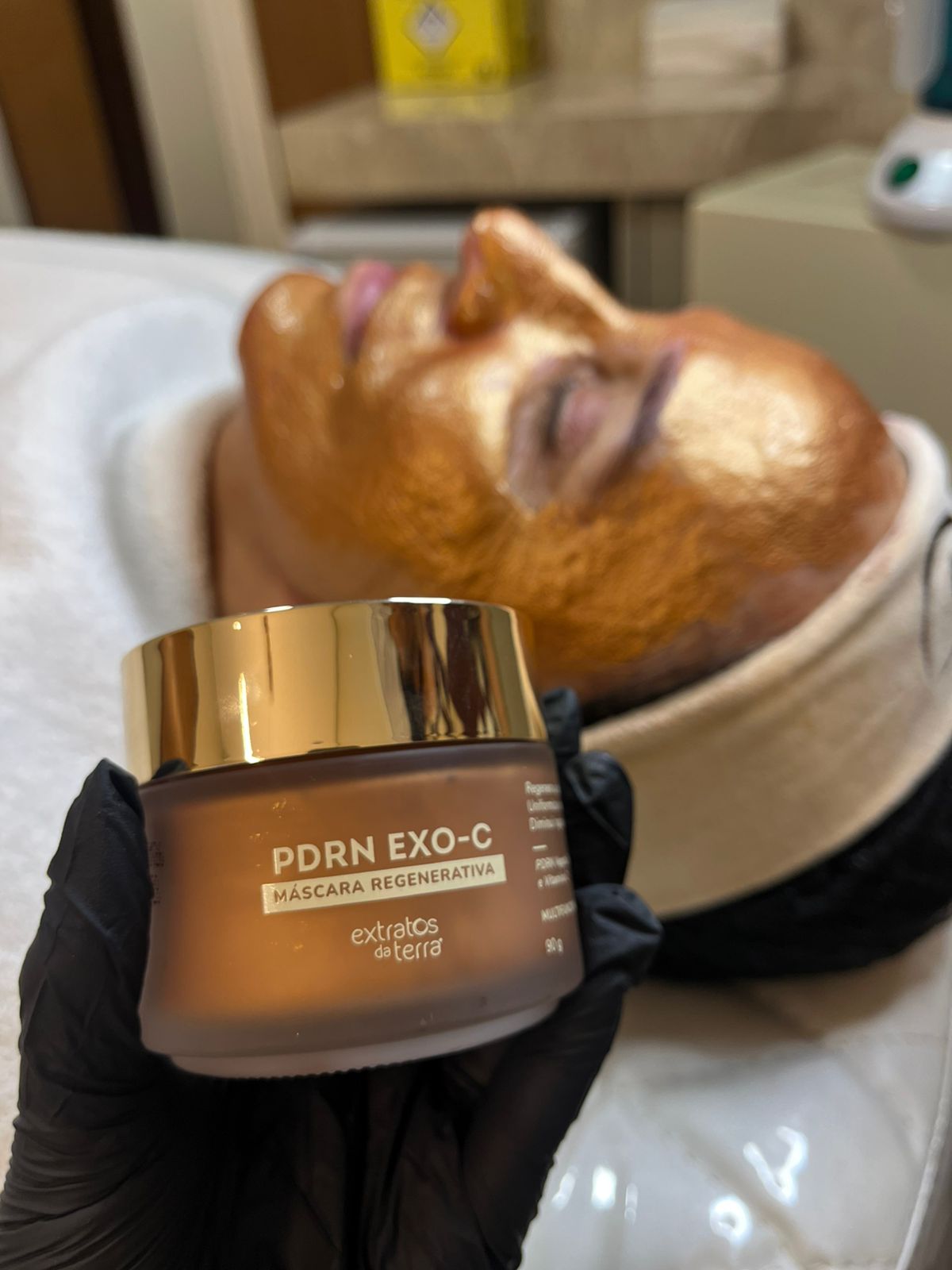 Peeling Químico